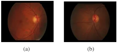 Fig. 1. Fundus images (a) Healthy (b) With MA 