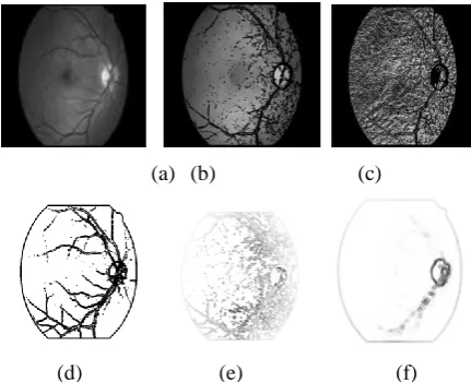 Fig. 2. (a) Median filtered image (b) Vessel removed image (c) LBP feature extracted image (d) Vessel mask 