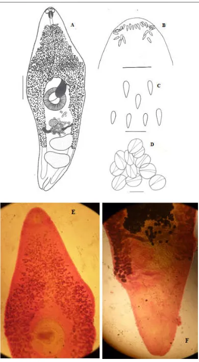 Figure 1. Pegosomum aftabi n.sp. A. Entire worm; B. Head collar; C. Body spines; D. Eggs; E