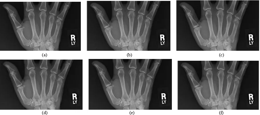 Figure 14. Decoded “X-ray” image with different quality values by our approach and JPEG2000