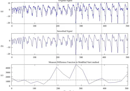 Figure 4. Signal segmentation in real EEG data. (a) Original signal; (b) Output of the simple Modified Varri (window length = 0.04 s, A1 = 7 and F1 = 1)