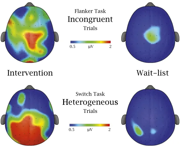 FIGURE 2Change in response accuracy (mean