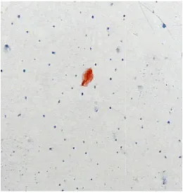 Figure 7. A diseased sample. A diseased sample  