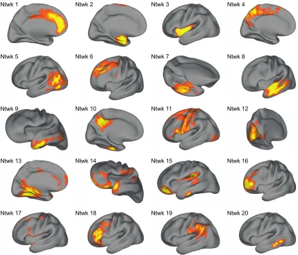 Figure 3. Structural covariance networks delineated by NMF.  prefrontal cortex (vmPFC), inferior temporal lobe, auditory cortex, temporoparietal junction (TPJ); 16) dorsal OFC; 17) the dura matter, a noise component that was not cortex, including the precu