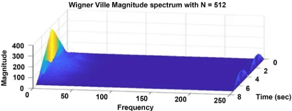 Figure 13. STFT magnitude spectrum with N = 512, nfft = 64 and overlap = 32 for Arrhythmia ECG signal with 10 sec time duration