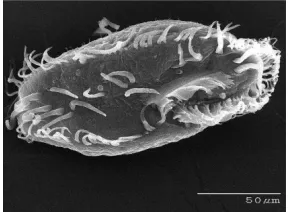 Figure 1. Ciliated protozoa Oxytrichia trifallax. 