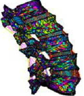 Figure 1. The obtained meshed lumbar unity. 
