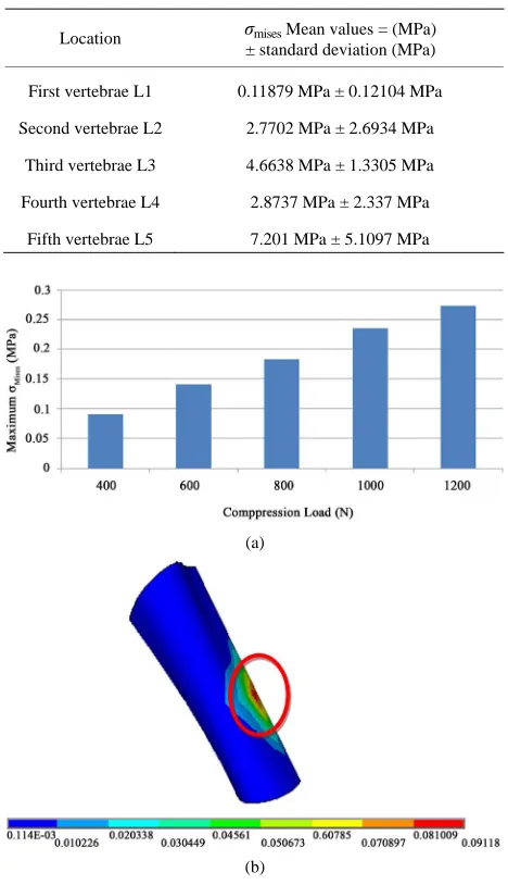 Table 2. Mean and SD values of σmises for the five vertebra in a case of a compression of 600 N