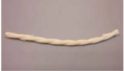 Fig. 8 The first biodegradable biliary stent used- “Archimedes 