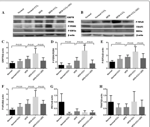 Fig. 7 Effect of JZG on protein expression of ERS related genes:to that ofIRE a-b Representative western blot results of GRP78, PERK, P-PERK, P-EIF2α, P-NFκB,α, and TRAF2 in rat liver tissues, c-h Densitometric analysis of GRP78, PERK, P-PERK, P-EIF2α, P-N