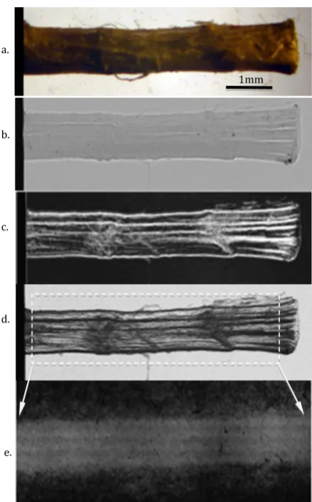 Figure 5. (Color online) The result of various kinds of imaging. (a) Optical microscope; (b) Absorption imaging; (c) DFI imaging; (d) BFI imaging; (e) SAXS imaging