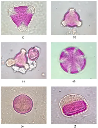 Figure 1. Examples of pollen discovered in honey. (a) ceae Prunus sp.; (b) Rubus sp.; (c) Rosa- sp.; (d) Satureja montana; (e) Trifolium repens; (f) Onobrychis viciifolia