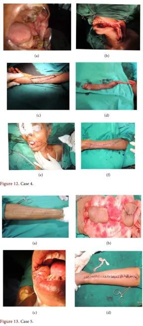 Figure 12. Case 4. 