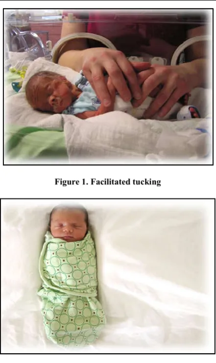 Figure 1. Facilitated tucking 