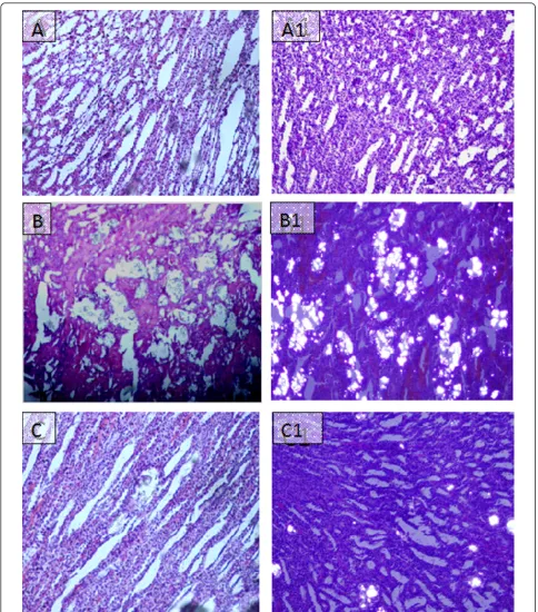Figure 8 Microscopic images of Kidney sections in preventive study. Representative microscopic images of the H and E stain of the kidneysections from normal (A), Lithogenic group (B) and Treated (C) with Ov.Cr