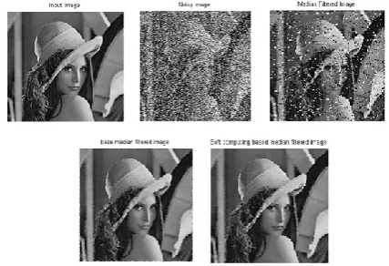 Fig 2. (a) Input Image (b) Noisy Image (c) Median Filtered Image  (d) Base Paper Image (e) Proposed filtered image 