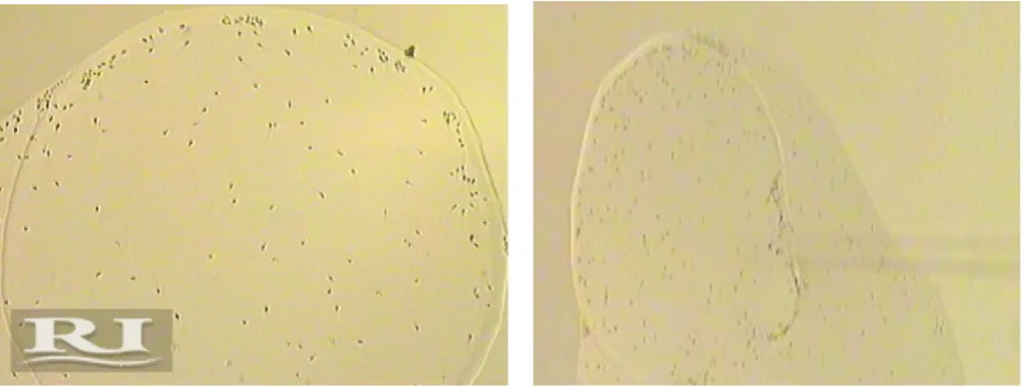 Figure 1. (a) Mature sperms bounded at the HA spot and immature sperms moves freely in the  dish (b)picking of mature HA  bounded sperm using injection needle   
