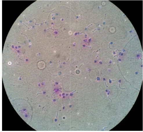 Figure 2. Slide with normal and abnormal sperm morphology Figure 2. Slide with normal and abnormal sperm morphology