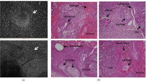 Figure 4. Differentiation of AdiPS cells transferred onto a Matrigel plate and treated with high serum/low growth factor medium for 3 to 4 weeks