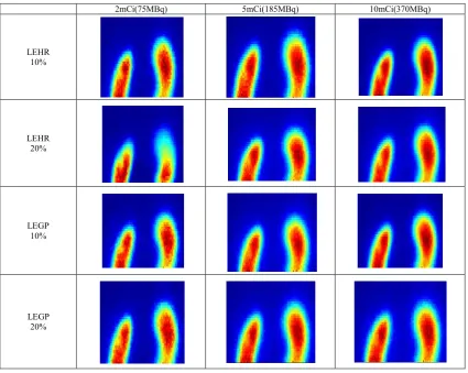 Figure 1. The image of simulated kidney scan with implementation of different factors 