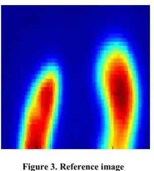 Table 3. Comparison of image quality parameters in different activities and energy windows by use of the LEGP collimator 