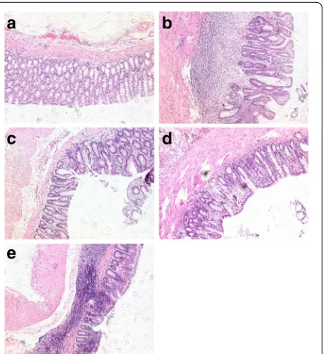 Fig. 1 CAS decreased DAI scores in TNBS-induced colitis in rats.Compared with the control group, *P<0.05; compared with the TNBSgroup, #P< 0.05