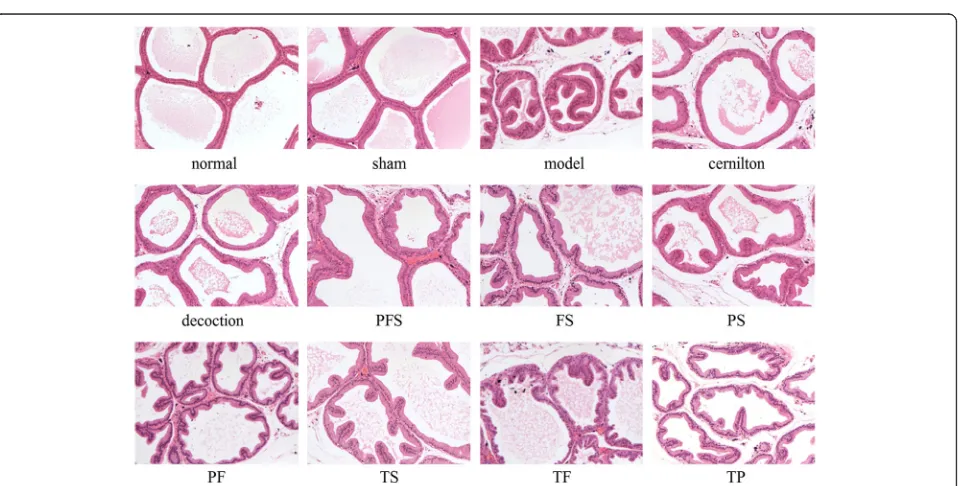 Fig. 4 Prostatic indexes of carrageenan-induced CP/CPPS rats afterthree-week oral administration of QYD and its extracts