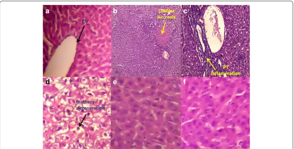 Fig. 8 Representative photomicrographs of immunohistochemical staining of caspase-3. a Liver of control rats, (b) Liver of rats intoxicated withCCl4 (0.5 ml/kg; P.O.), (c) Liver of rats intoxicated with CCl4 and treated with N