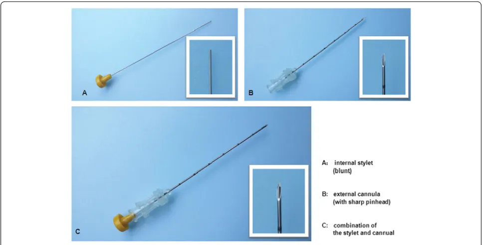 Fig. 4 Insert the catgut into the cannula of the needle