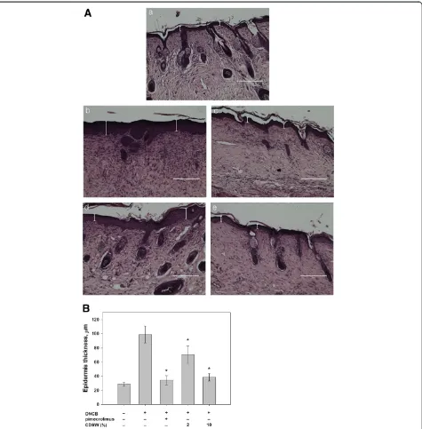 Figure 3 Change in skin epidermal thickness elicited by the repeated topical application of DNCB in NC/Nga mice