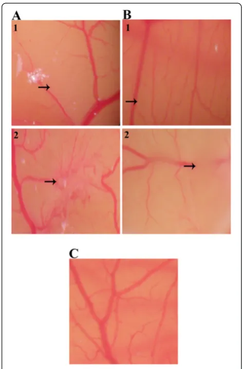 Figure 5 Effects oftreated with EtOH extract and (treated with (1) 25 P jiringa fruit rind extracts onneovascularisation in chick chorioallantoic membrane
