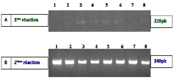 Figure 4. Comparative test between the 2 reactions of nested PCR-STR  