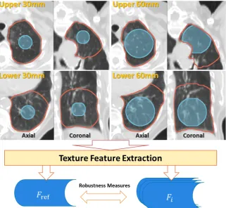 Figure 1. A flow chart for the robustness analysis of normal lung CT texture features ex-tracted from the PTR (red contour excluding the simulated blue GTV)