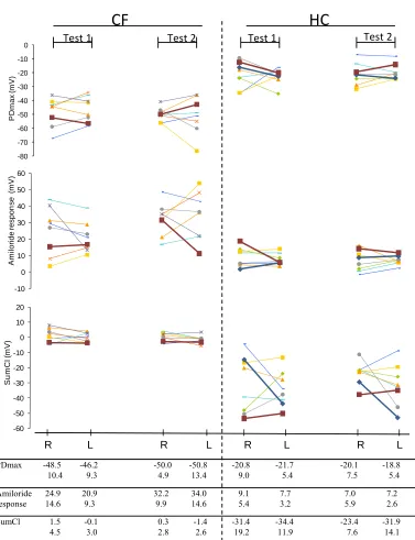 Figure 2. Individual and mean, SD values (mV) of maximal baseline (PDmax), amiloride response and total chloride response (SumCl) obtained from right (R) and left (L) nostrils of 8 patients with CF and 8 healthy control (HC) subjects at two differ-ent meas