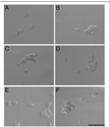 Figure 1 Effects of ECa 233 on cell viability and proliferation ofIMR-32 cells at 24 and 48 h after applying