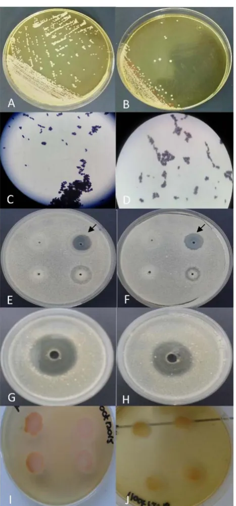 Figure 4. Phenotypic characterization of an isolate of canine origin (column on the left) and an isolate from its owner (column of the right)