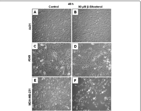 Figure 4 Effect of(control) or 60 and 90 β-sitosterol (ST) on apoptosis and Bax/Bcl-2 ratio in breast carcinoma cells