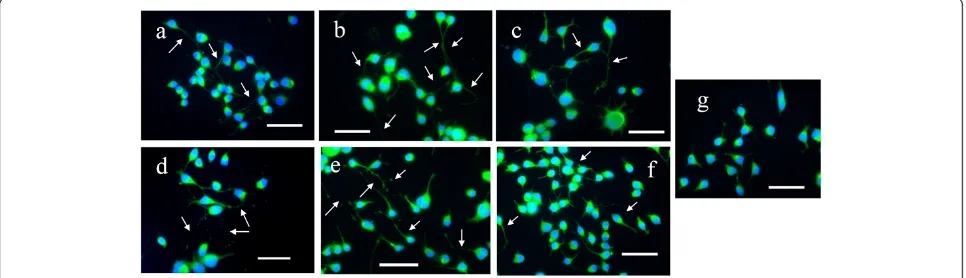 Figure 4 Phase-contrast photomicrographs showing the effects of (a) NGF, (b) G. lucidum, (c) L