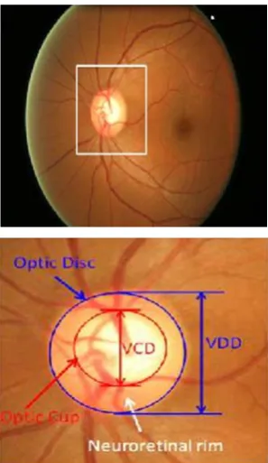 Fig. 4. Major structures of the optic disc. The region enclosed by the blue 