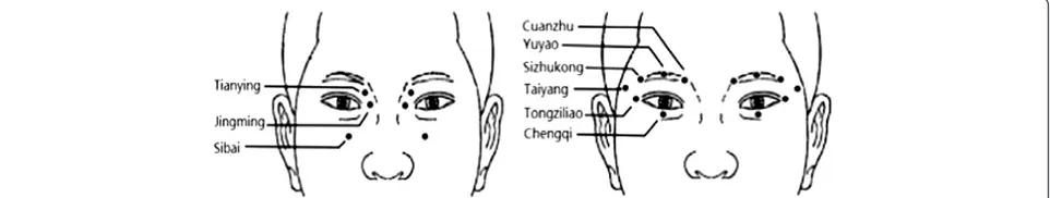 Figure 1 Schematic diagram showing the positions of the acupoints used for eye exercises of acupoints