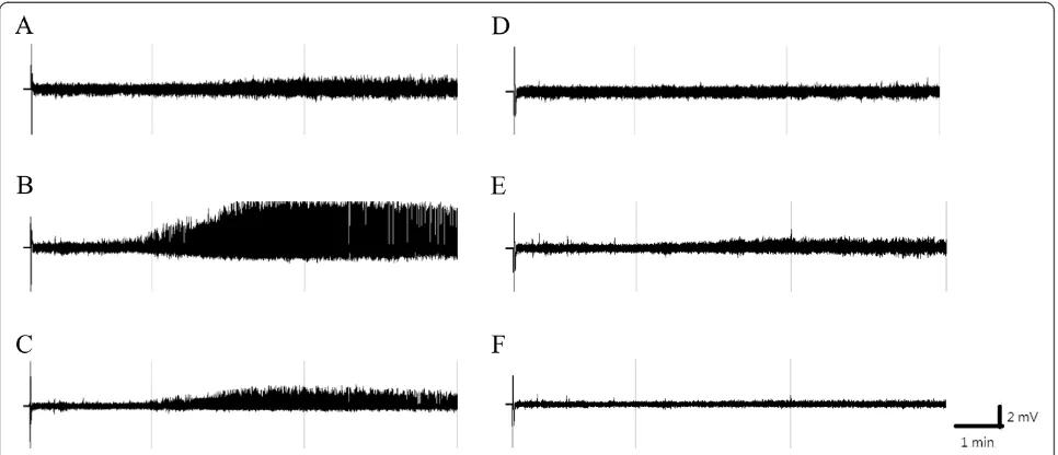 Figure 2 The focal epilepsy induced by microinjection of pilocarpine into the CeA.acquired from the electrodes of left frontal, left parietal, left occipital, right frontal, right parietal and right occipital cortices, respectively