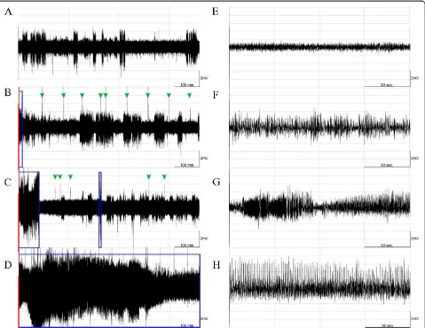 Figure 3 The effect of 100 Hz EA stimulation of bilateral Feng-Chi acupoints on the epileptic activities