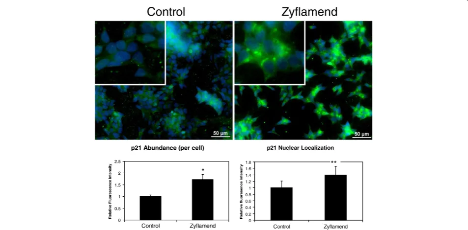 Figure 4 Zyflamend and its effects on cellular p21 expression as determined by immunofluorescent imaging using CWR22Rv1 cells.Cells pretreated with 200 μg/ml Zyflamend for 24 hours (right) were compared with control cells (left)