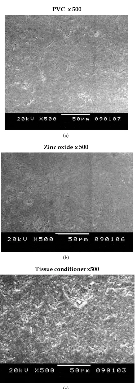 Figure 2. (a, b, c): The stone cast specimens were observed under SEM at 500X magnifi-cation