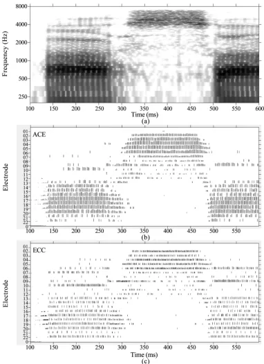 Figure 8. Spectrogram and electrodograms of the first 500 msec of the speech token “asa” with ACE versus ECC