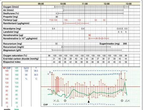 Fig. 2 Anesthesia record. X, start and end of anesthesia; Δ, tracheal intubation and extubation; ◎, start and end of surgery; ▲, resection of the tumor