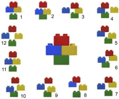 Figure 2. The Hertel Classification for proximal Humerus Fractures (Lego classification) [7]