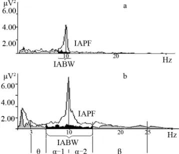 Figure 5dard theta/beta decreasing neurofeedback training protocol 