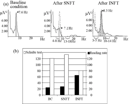 Figure 5. Spectra power (a) and psychometrical test per- formance (b) of boy with attention deficit disorder in baseline condition (b, c), after 10 sessions theta/beta decreasing neu-rofeedback training in standard EEG ranges (SNFT-theta = 4 - 8 Hz and bet