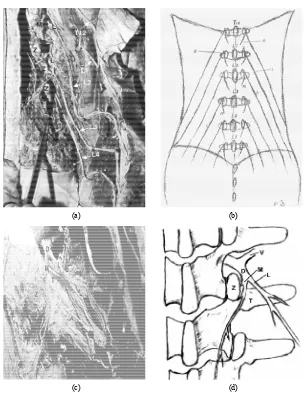 Figure 1. Dissection of the dorsal rami. (a) and (b) A posterior view of the right T12, L1, L2, L3 and L4 spinal dorsal rami nerves